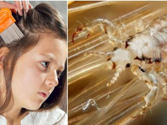 Lice warning